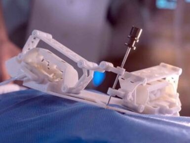 Spirits : Robotique pour la chirurgie et la radiologie interventionnelle