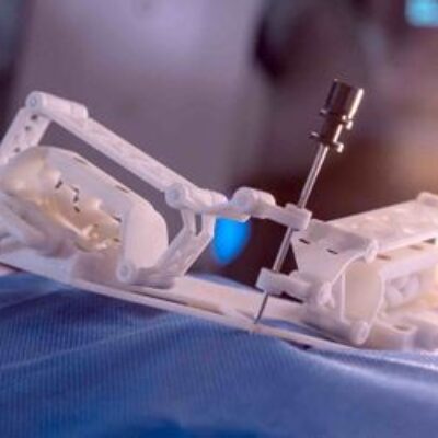 Spirits : Robotique pour la chirurgie et la radiologie interventionnelle